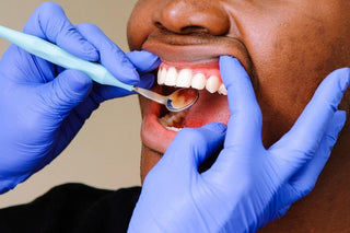 Dental Implants and Teeth Whitening: What You Need to Know for a Consistent Smile