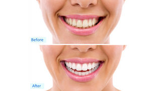 Innovative Dental Care Services in Wichita: Your Guide to a Brighter Smile