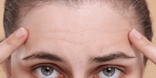 Skin with wrinkles