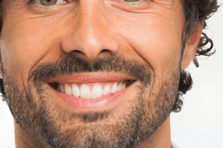 Close-up of a man smiling with clean, bright teeth